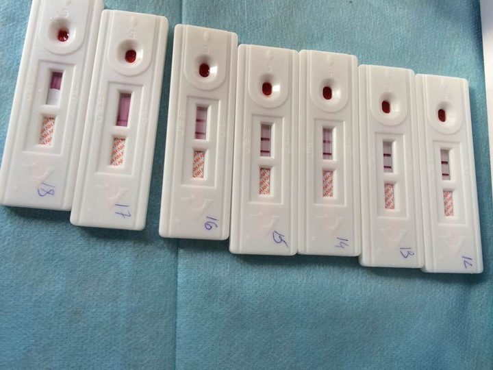Инструкция экспресс теста на вич. Экспресс тест на ВИЧ 2 полоски. Экспресс тест ВИЧ 1/2 положительный. Экспресс тест на ВИЧ 1/2 2 полоски. Экспресс тест на ВИЧ HIV кассета.