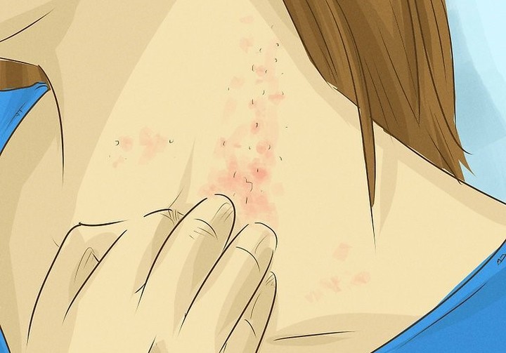 content scratches clipart skin disease 20